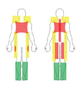 The Rolfing SI 10 Series Part 1